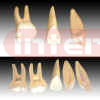 Expansion model of human teeth